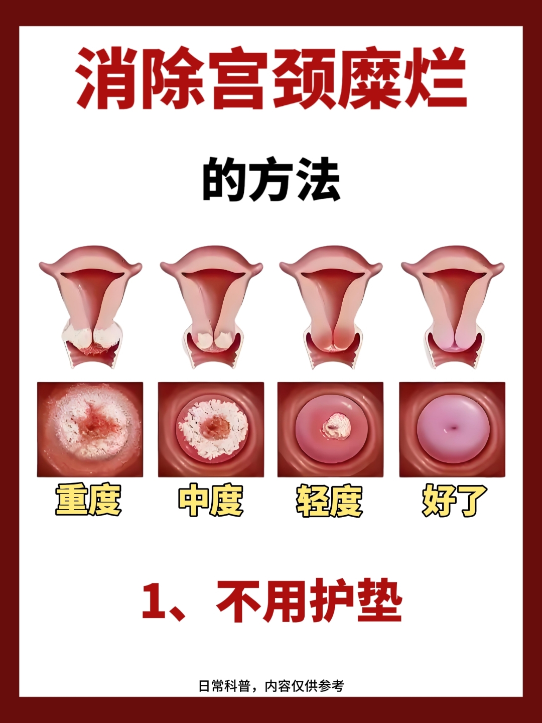 宫颈肥大的症状有哪些?