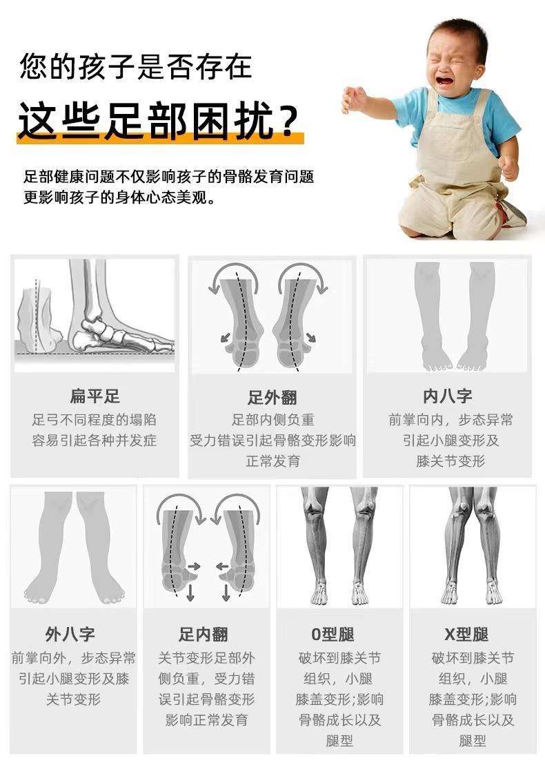 扁平足的矫正方法