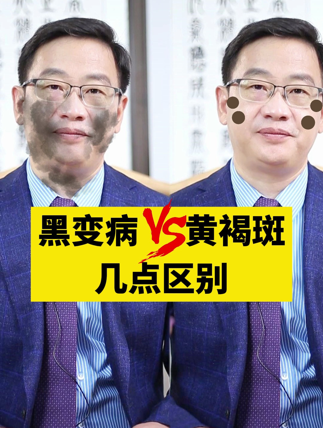 黑变病是什么?