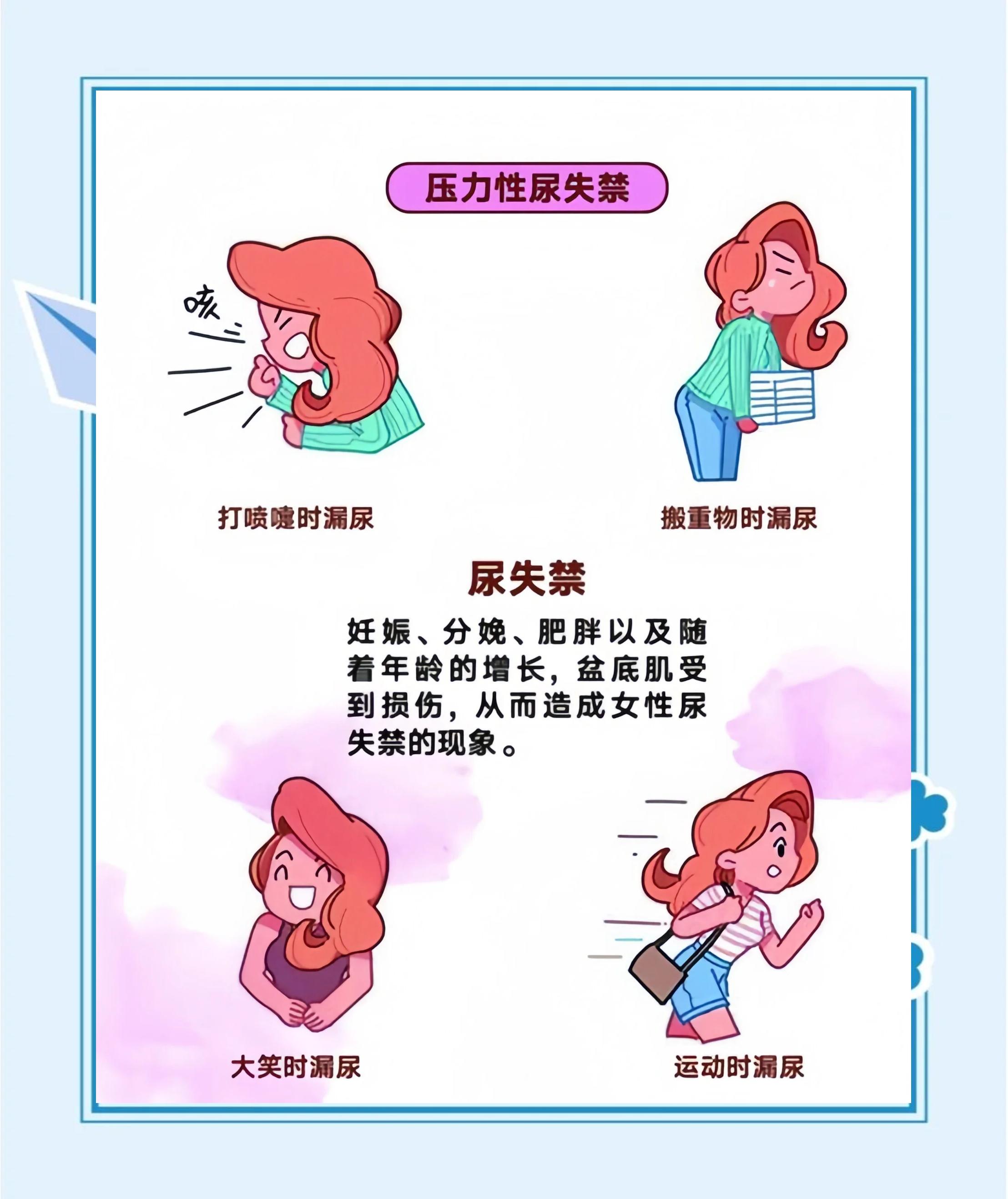 咳嗽时小便失禁怎么办