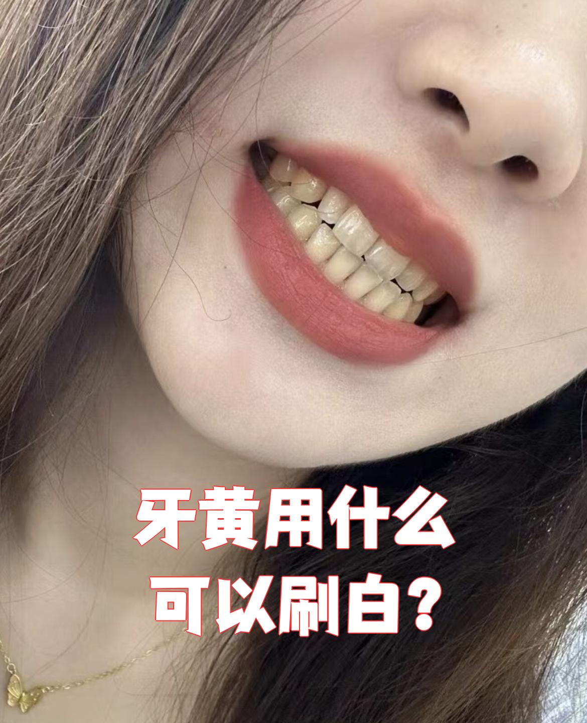牙齿为什么会变黄
