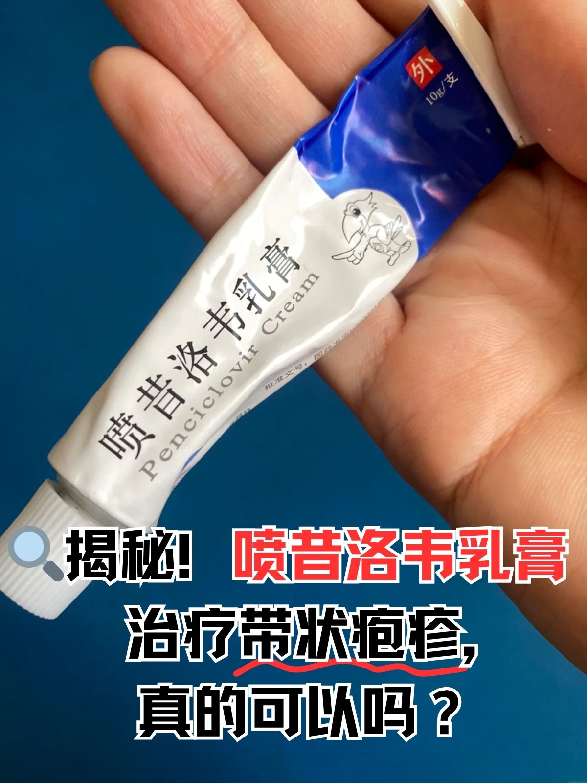 带状疱疹可以吃鸡蛋吗