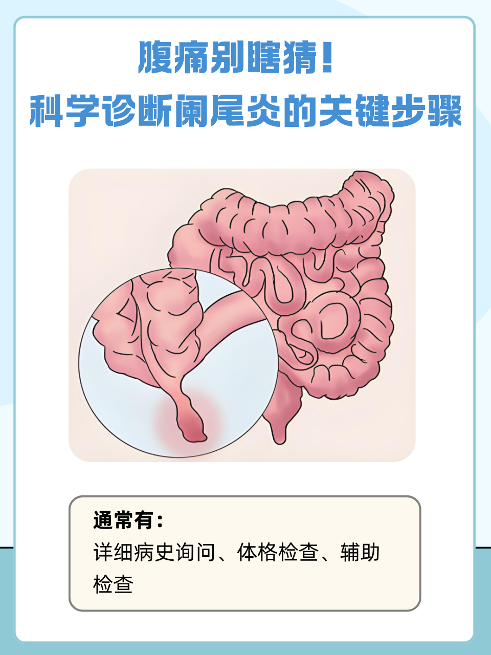 如何判断是否为阑尾炎