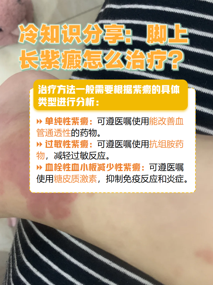 过敏性紫癜能治好吗