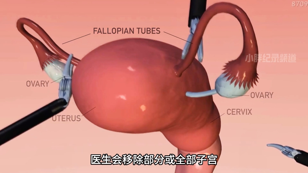 宇新之 第2页