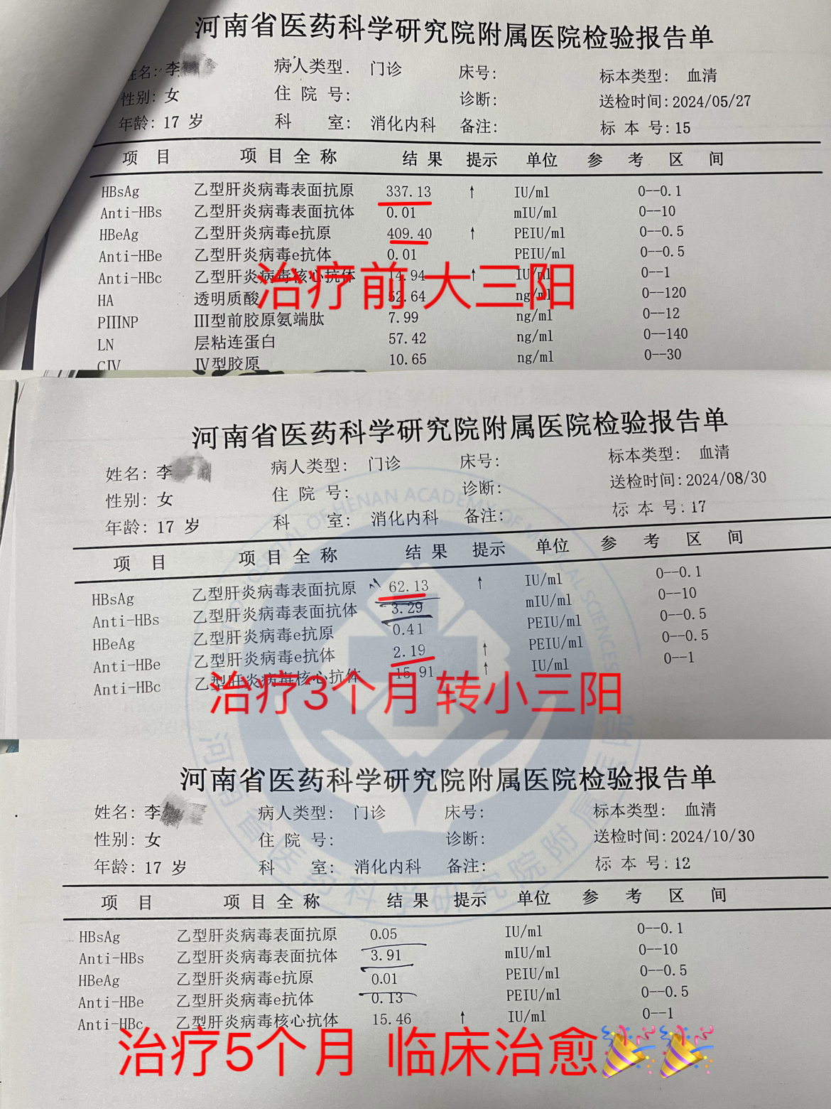 乙肝要怎么治呢