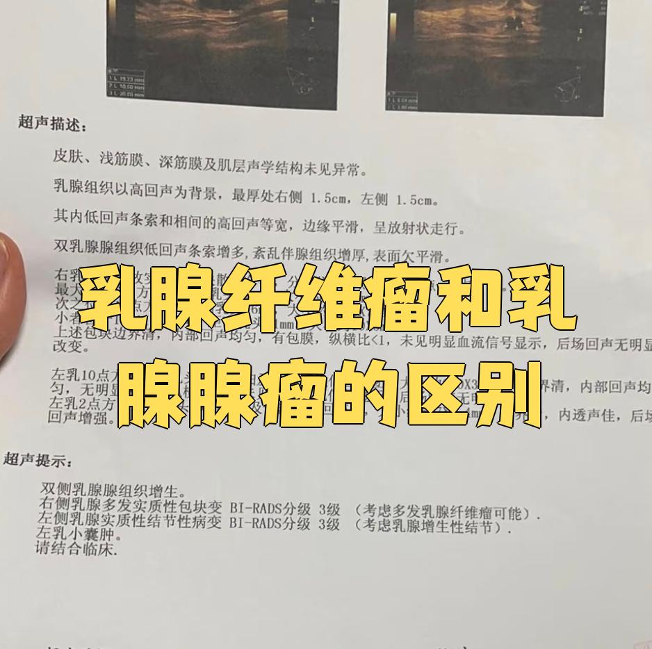 乳腺纤维腺瘤是怎么回事