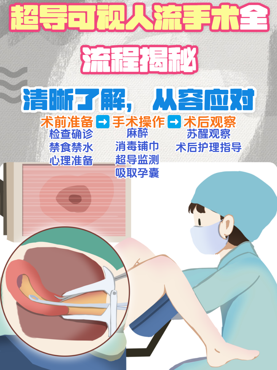 什么是完全流产