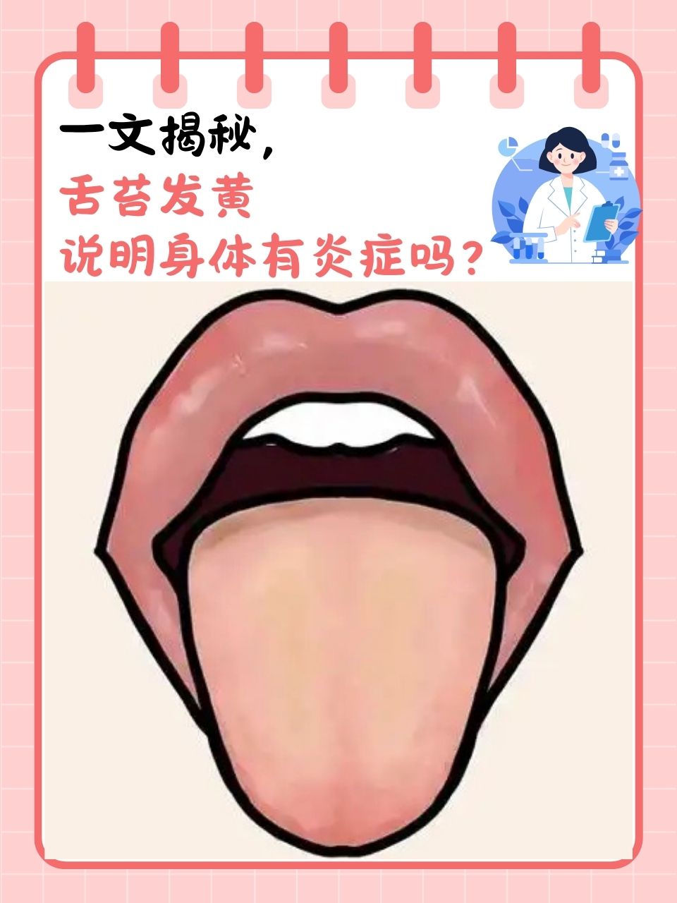 舌苔黄厚,是怎么回事呢?