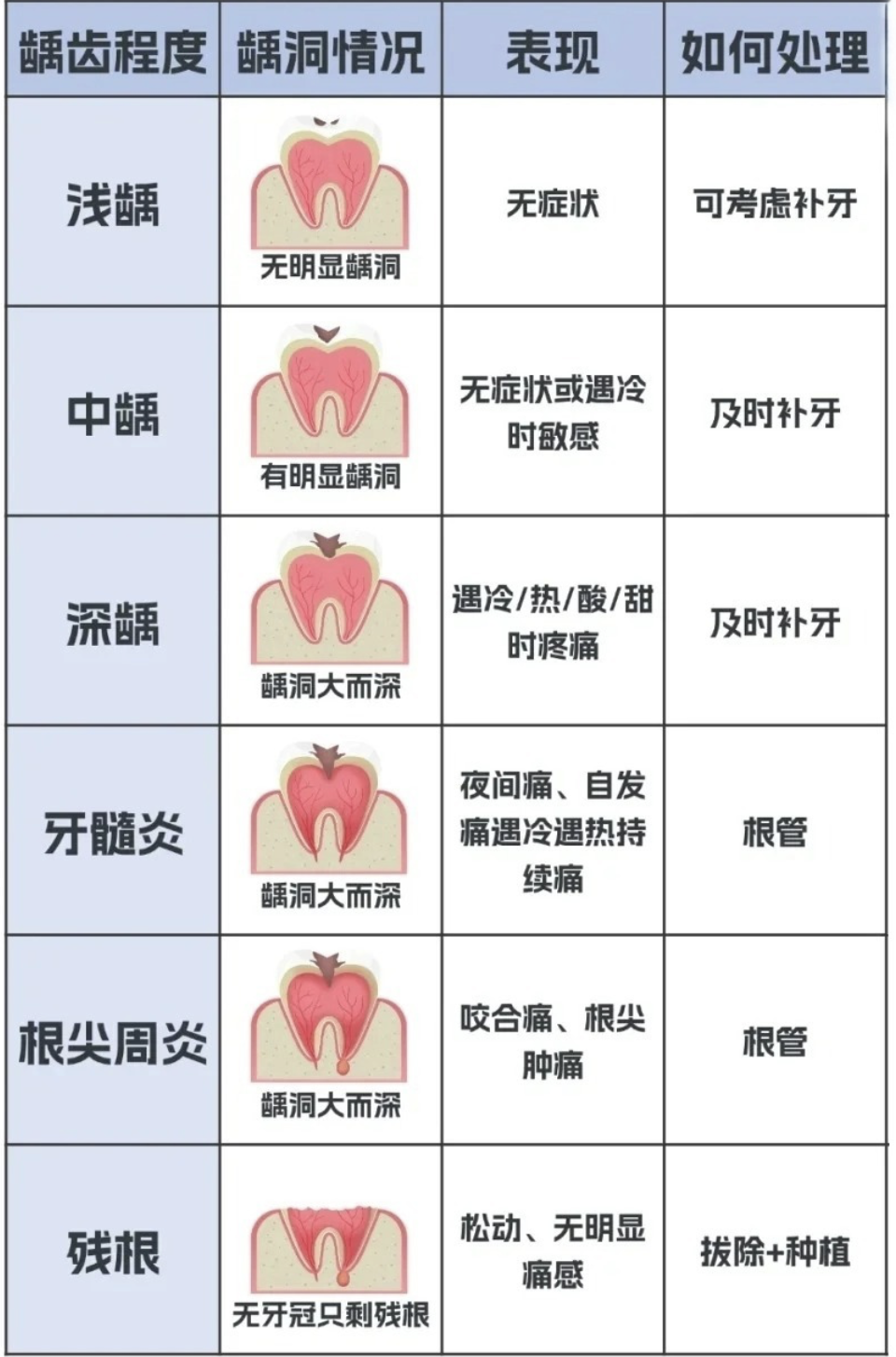 龋齿是怎么引起的