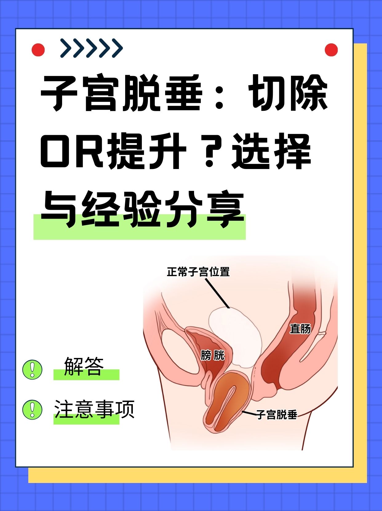 子宫脱垂怎么治疗比较好