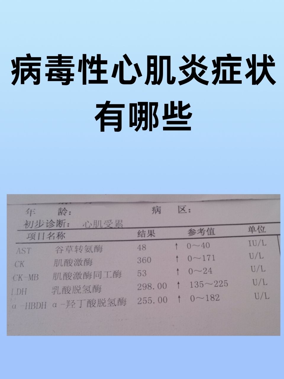 重症心肌炎的症状
