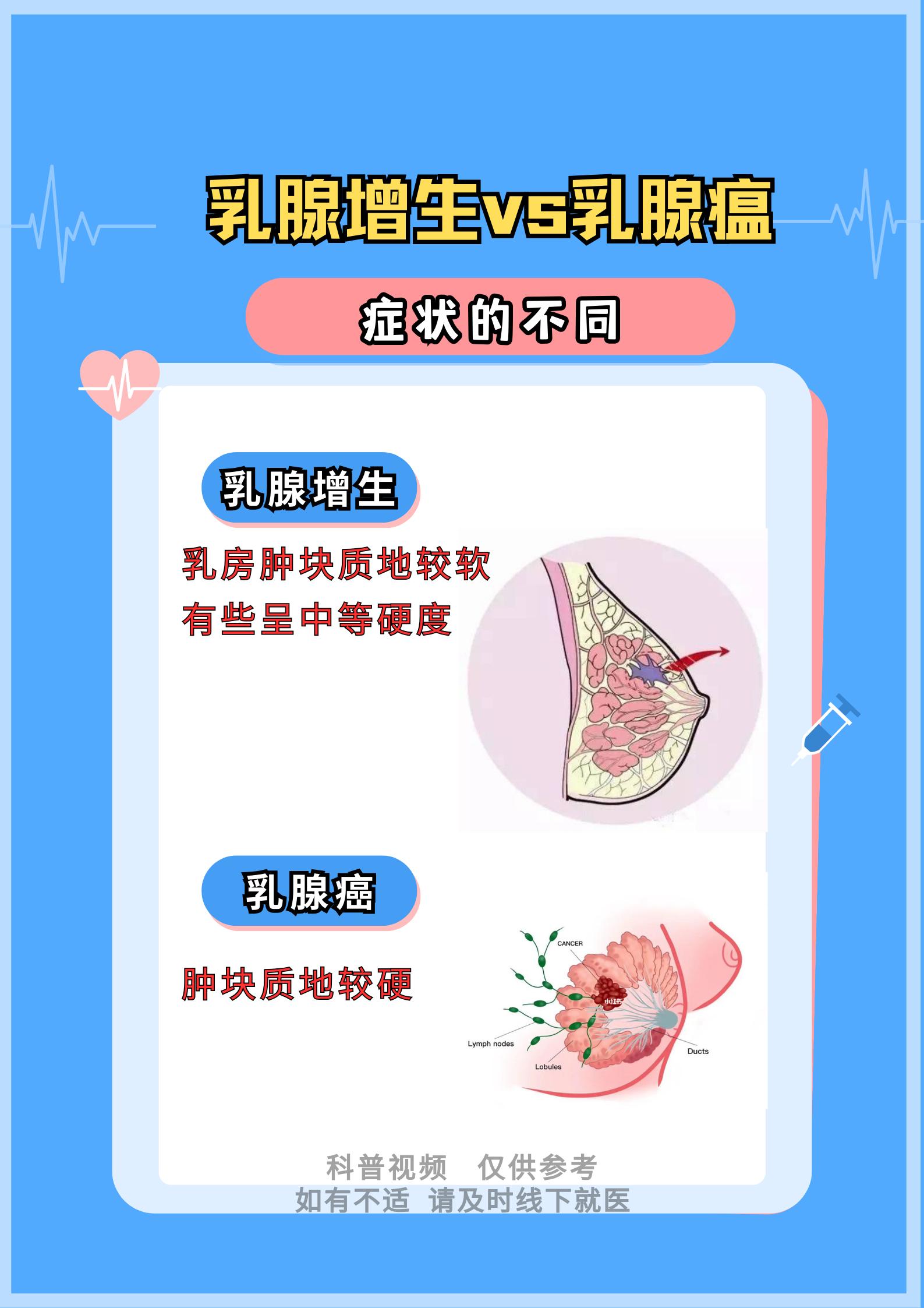 乳腺癌的早期症状
