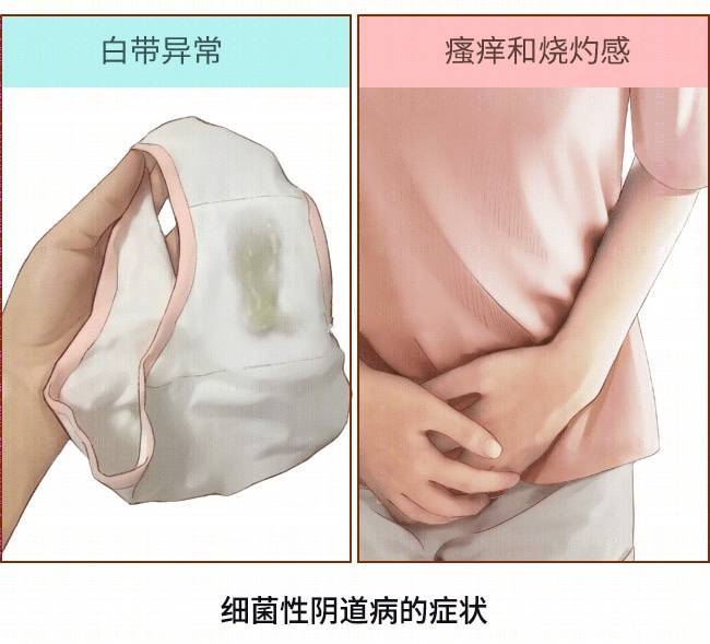 白带发黄外阴瘙痒怎么治疗