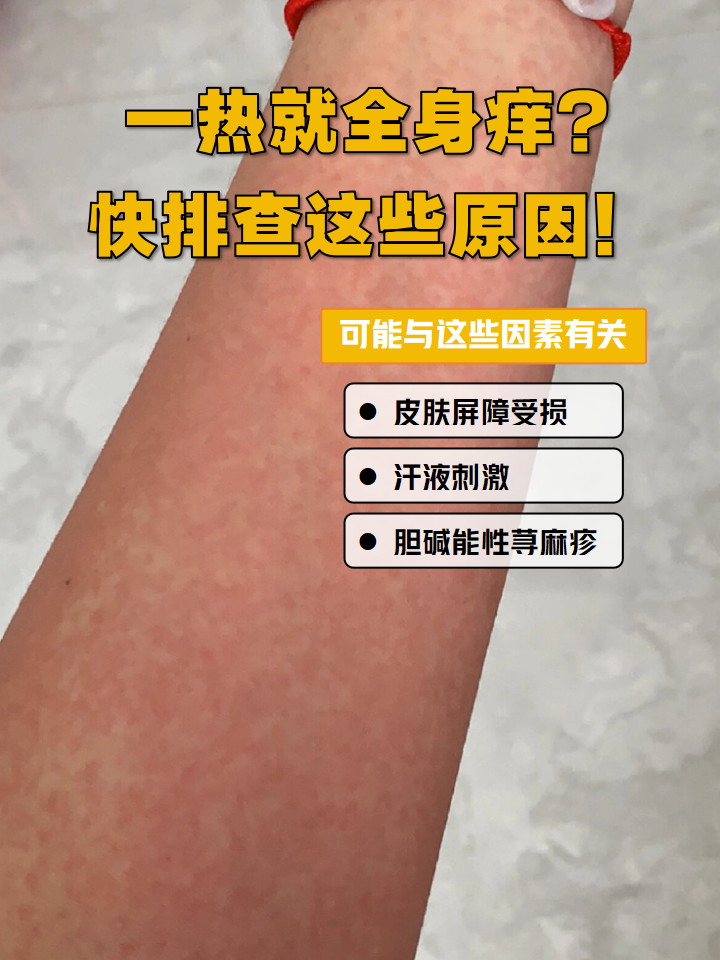 全身痒痒是怎么回事?