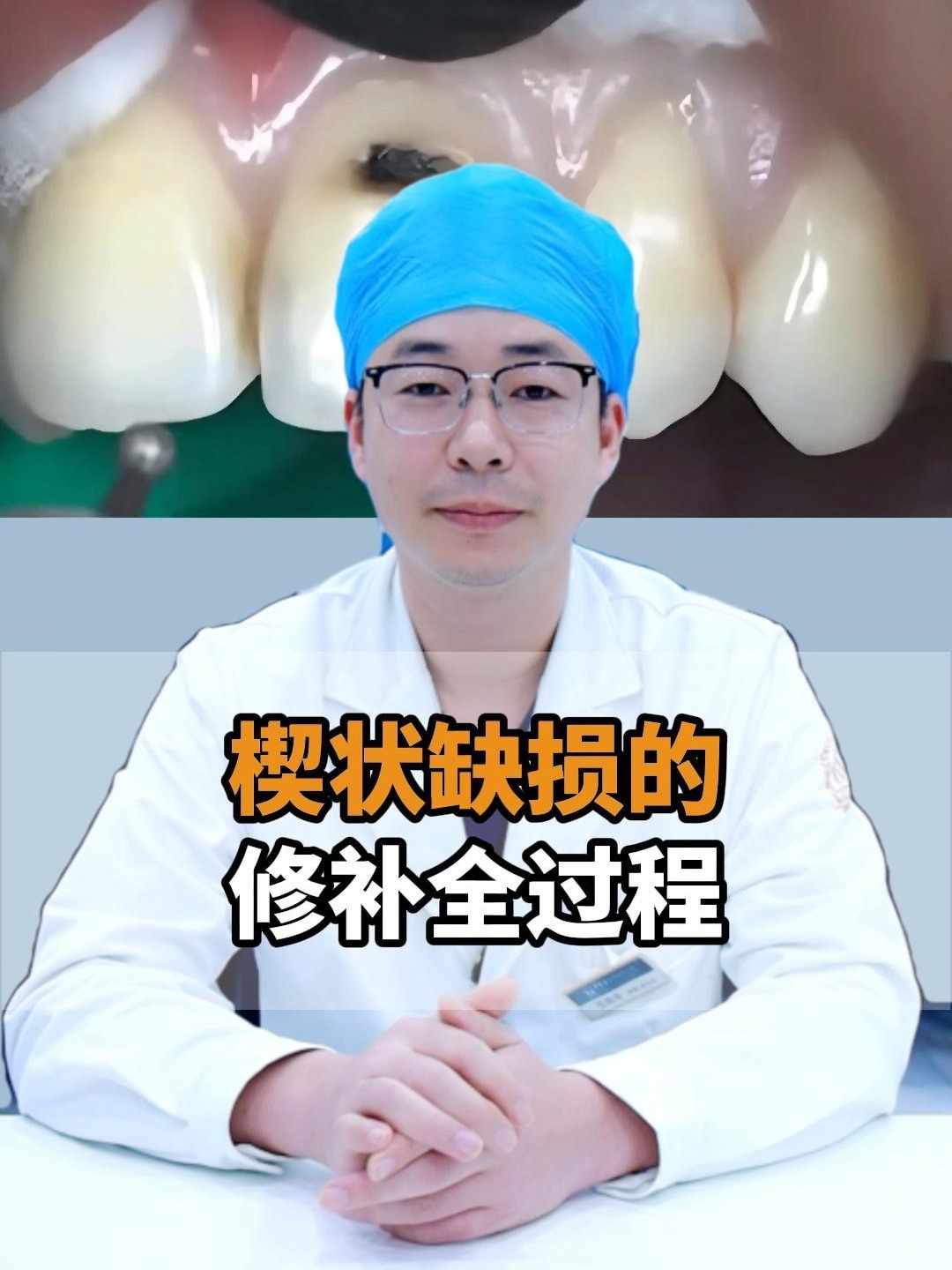楔状缺损怎么办