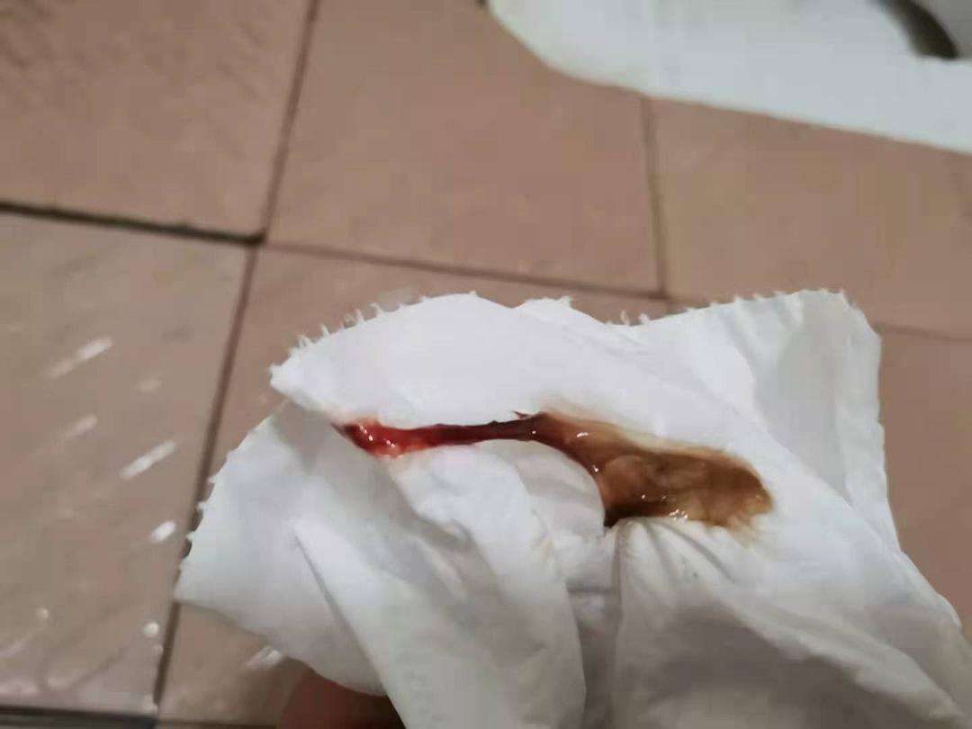 白带带血小腹还隐约疼是怎么回事