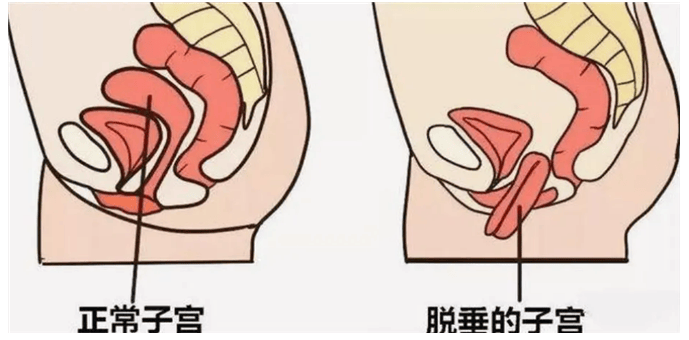 女人在过性生活的时候,把腿张开,就会露出阴道吗?