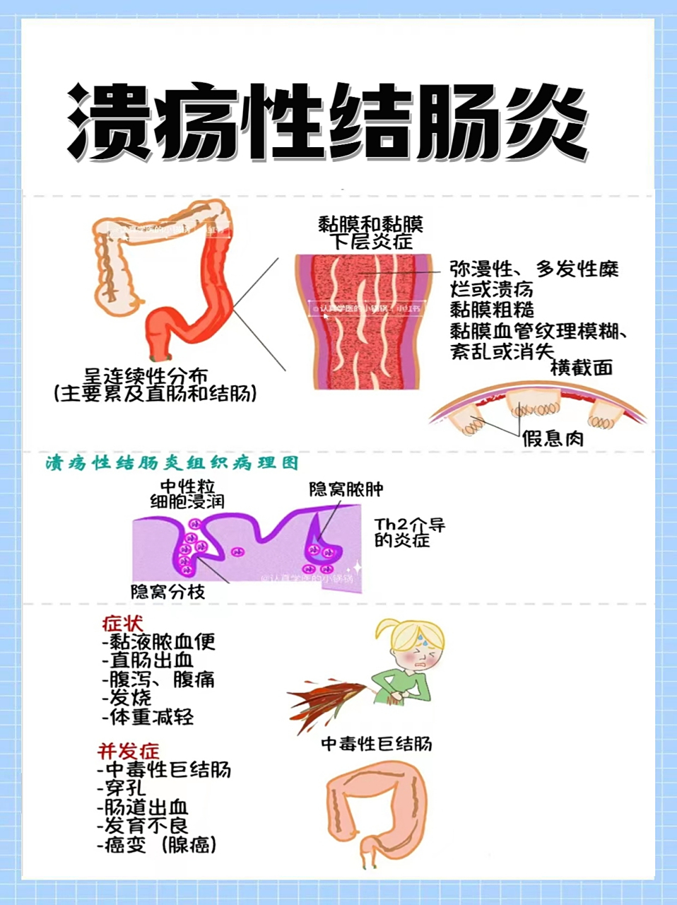 肠炎的症状及治疗