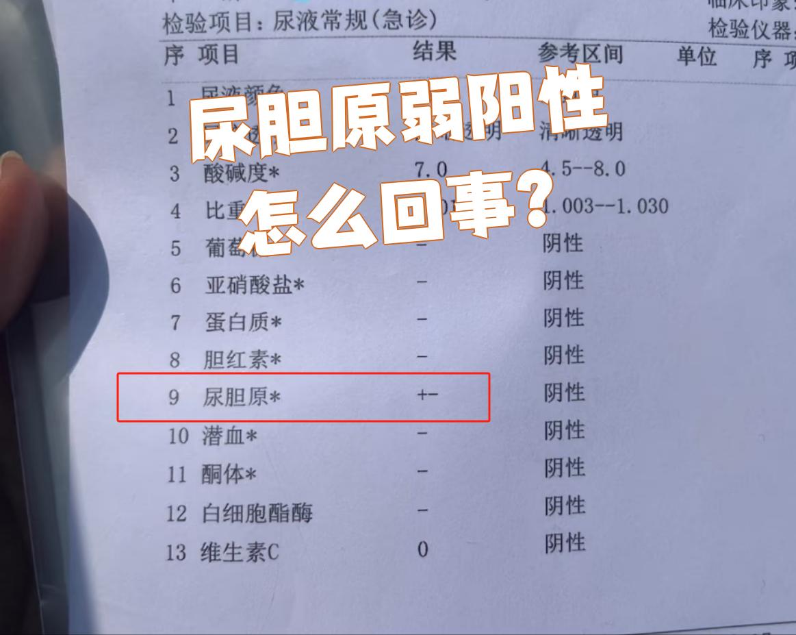 尿胆原是什么?
