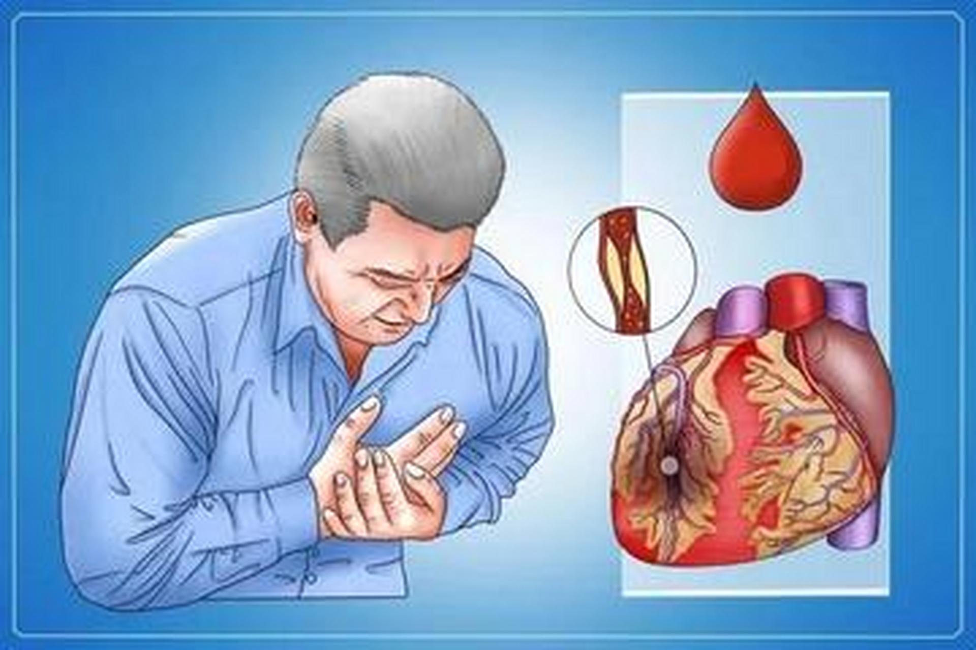 遗传性心脏病