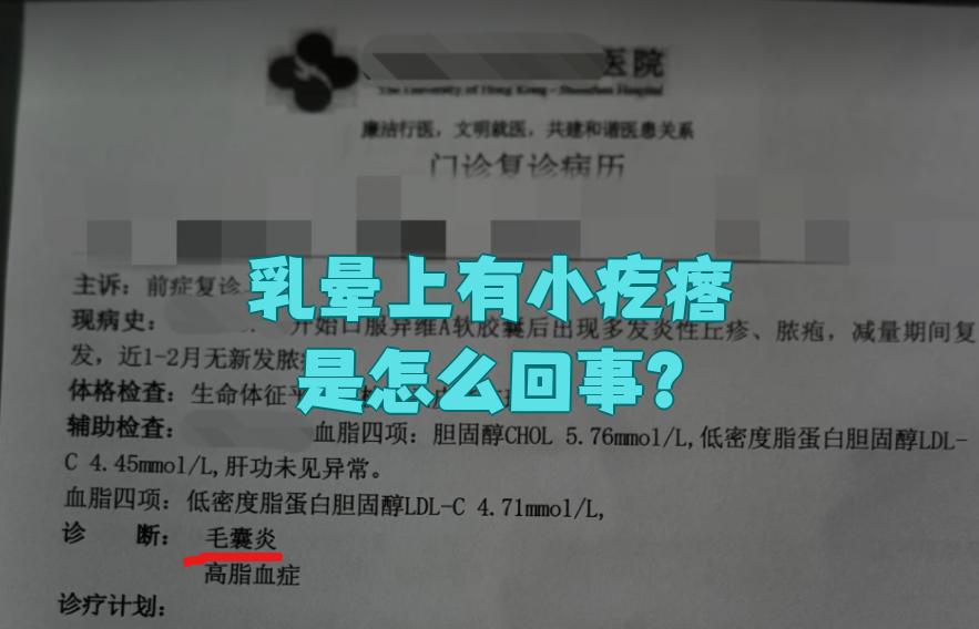 乳晕上有疙瘩怎么回事