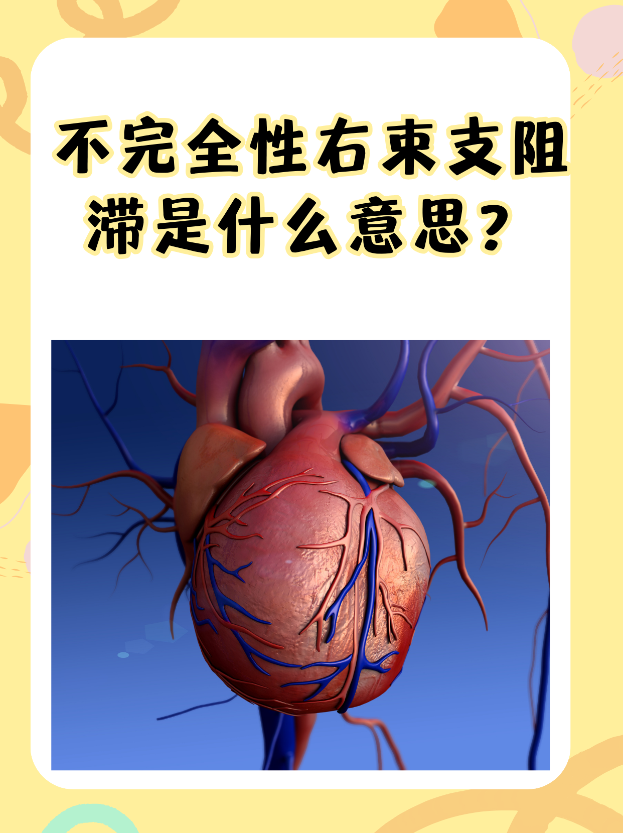 心脏二度传导阻滞,能治好吗