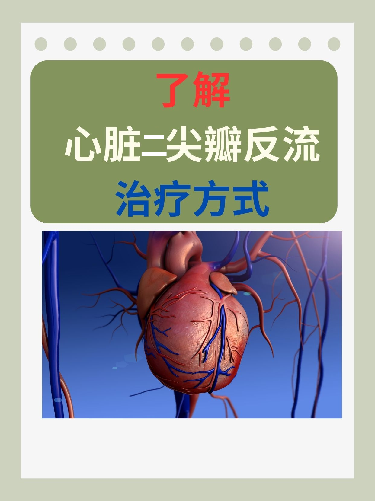 心脏二尖瓣轻度返流