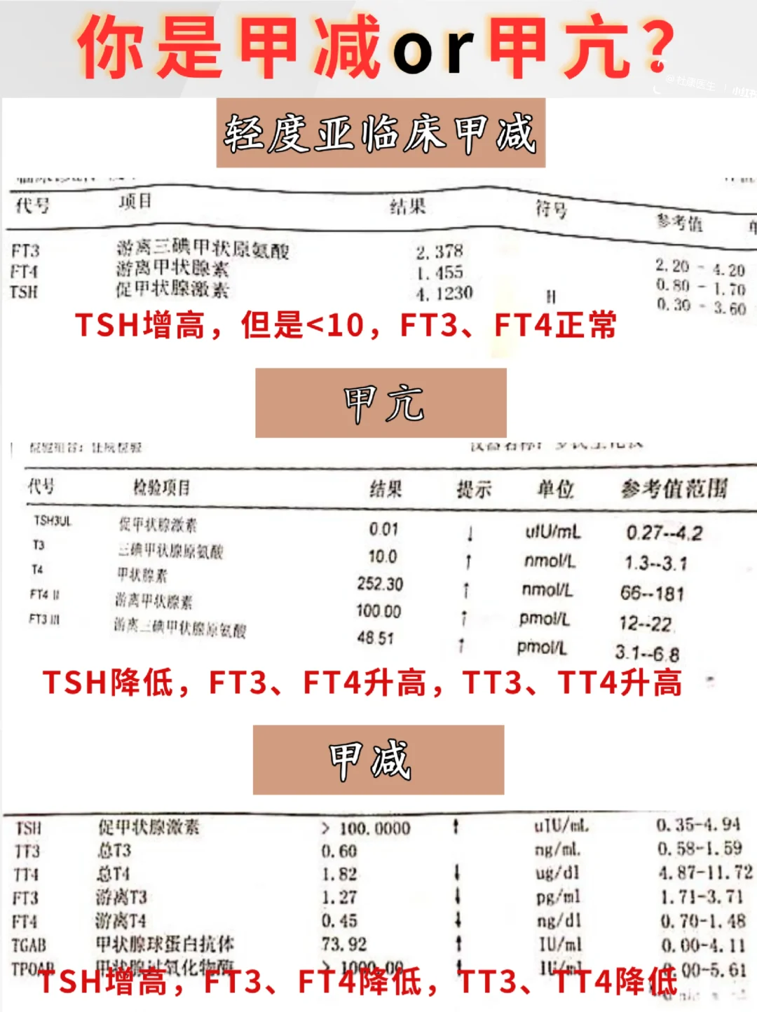 tsh高是什么原因