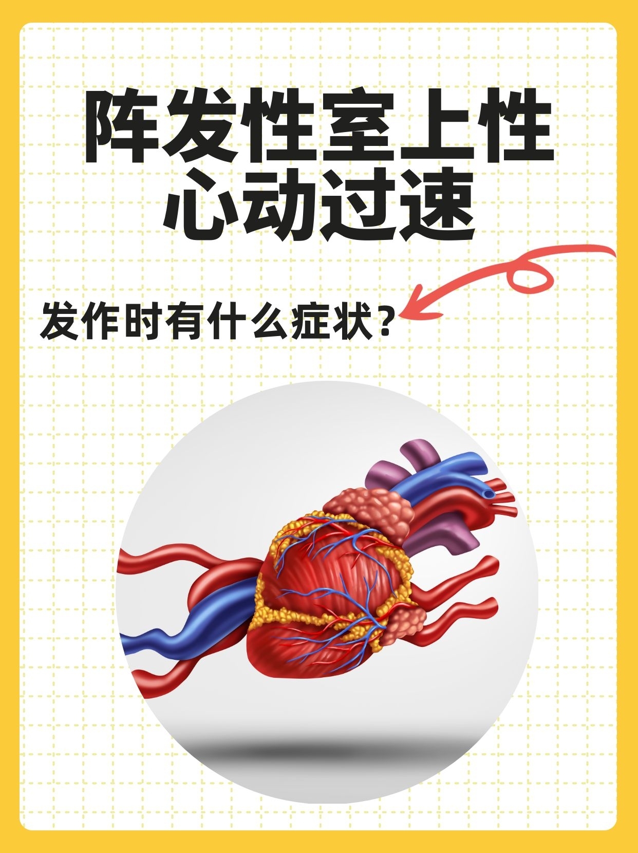 心动过速是什么原因