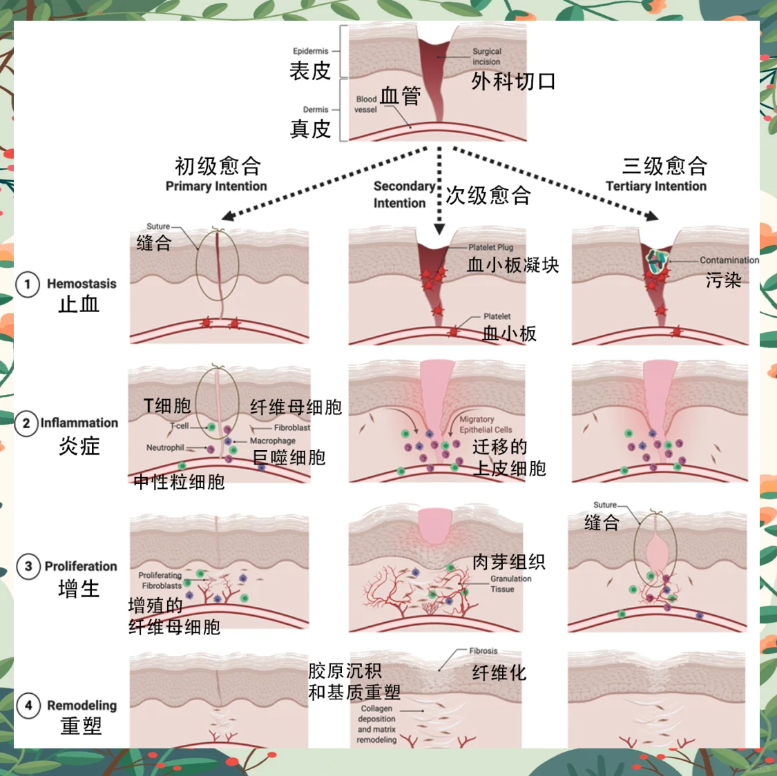手术后伤口不愈合是什么原因