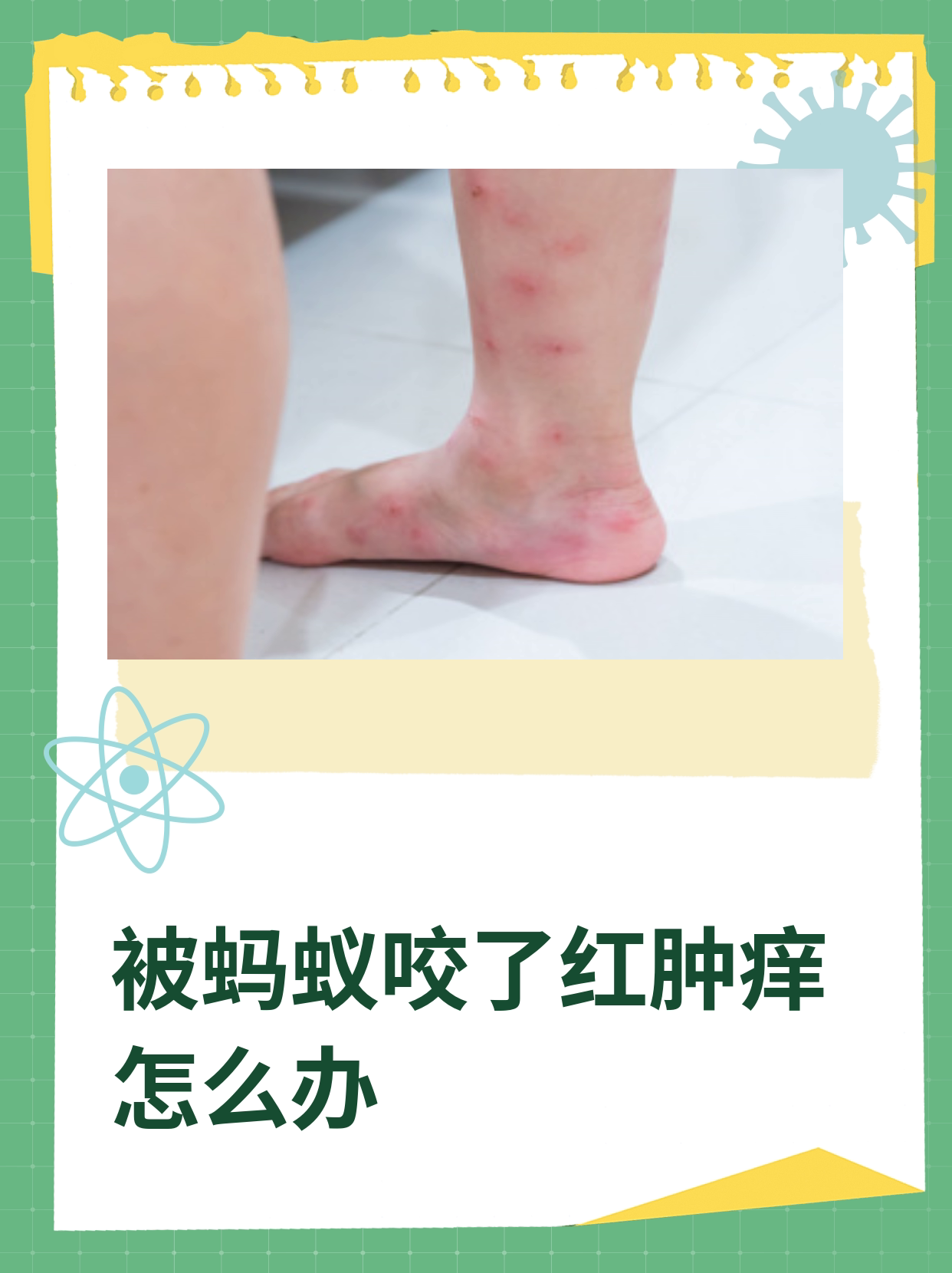被蚂蚁咬涂什么药膏比较好