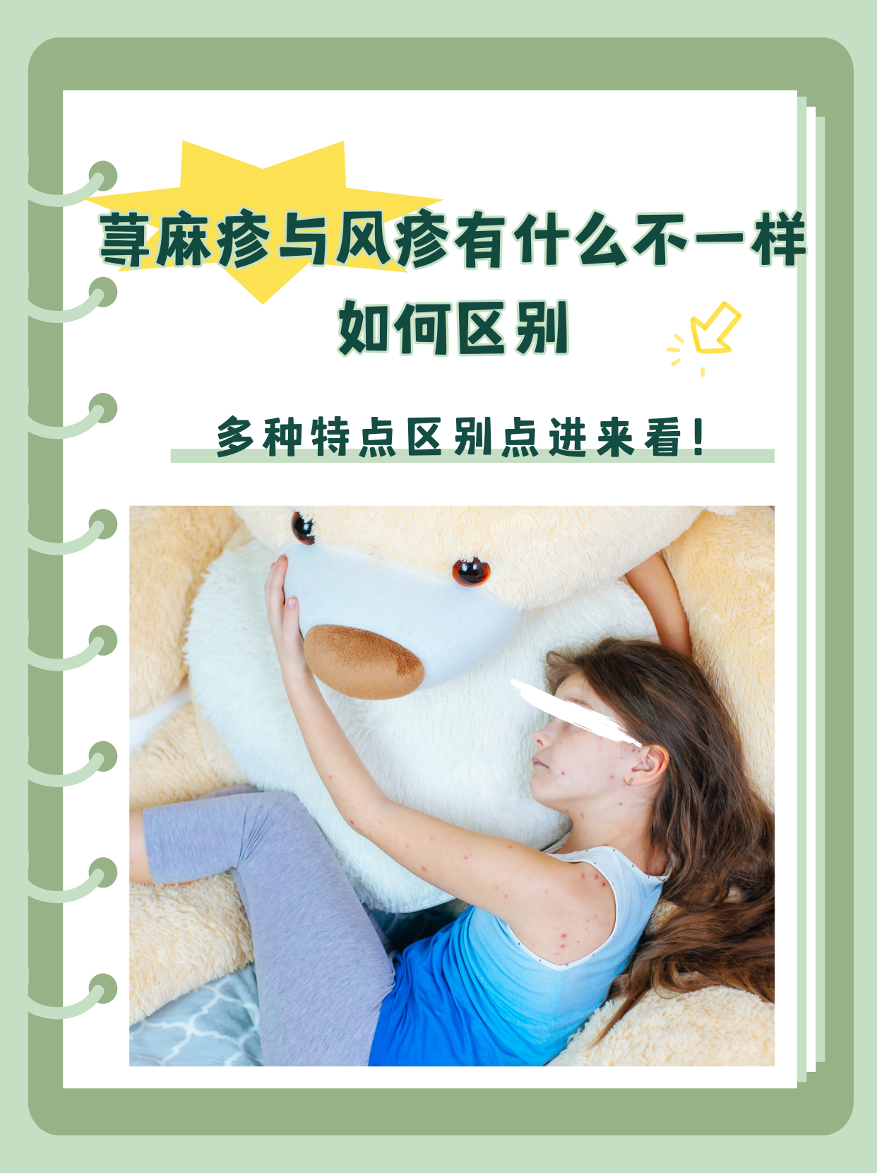 麻疹和荨麻疹的区别