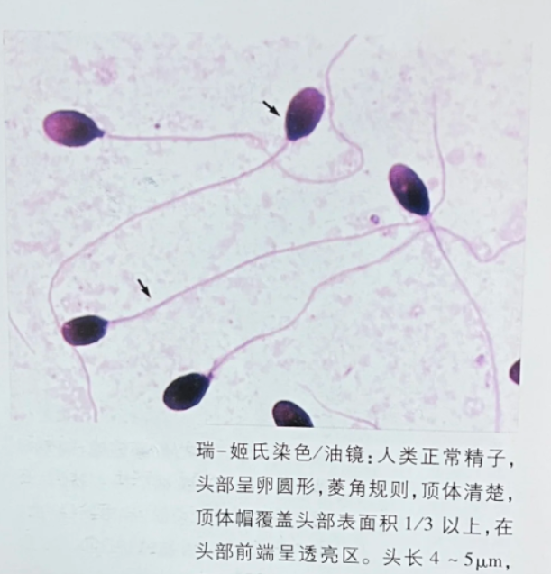前列腺液有精子吗