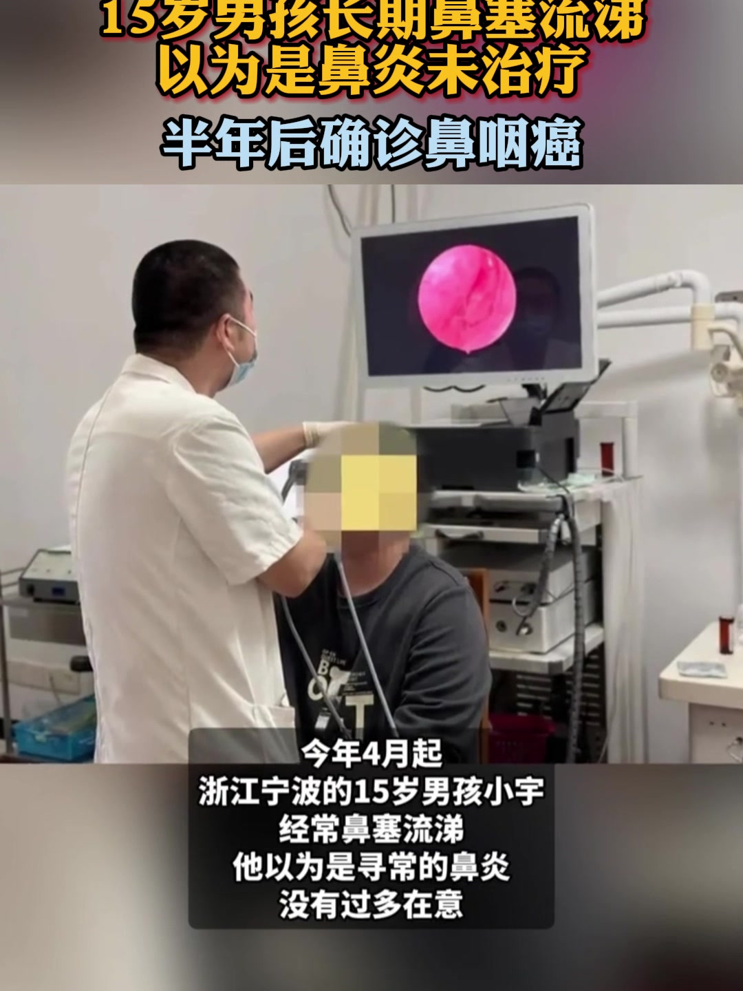 鼻咽癌能活多久