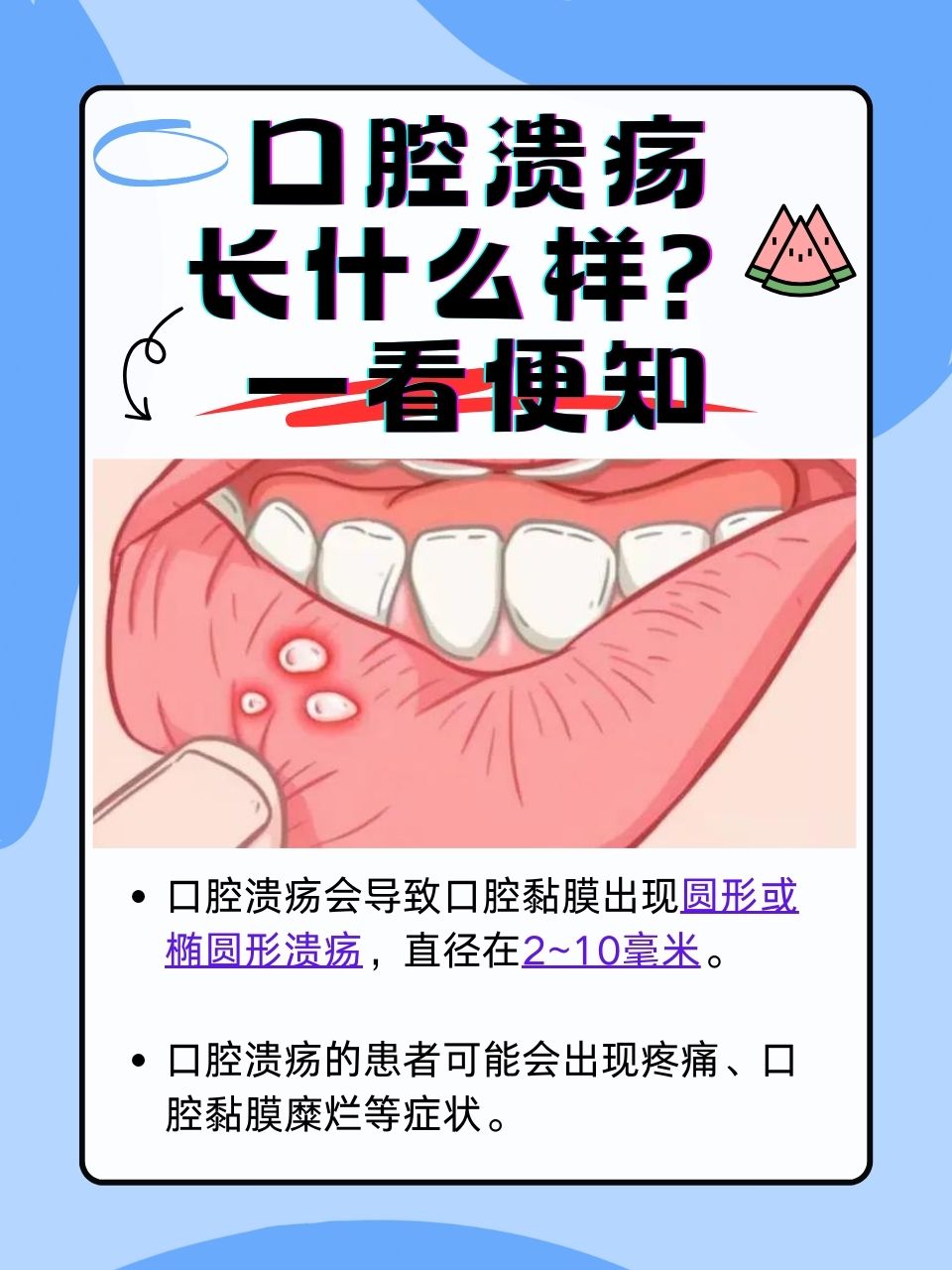 为什么总是口腔溃疡