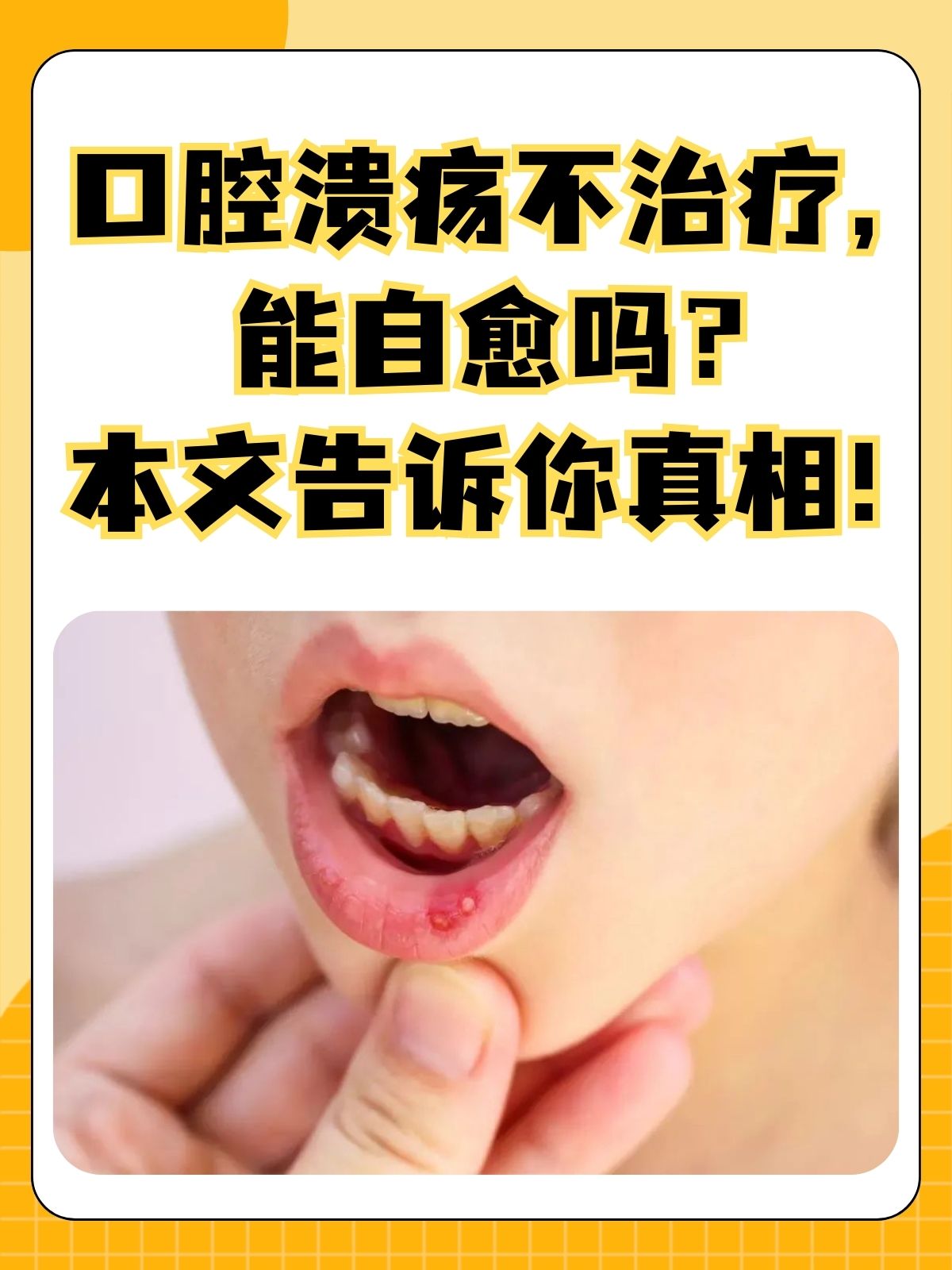 为什么总是口腔溃疡