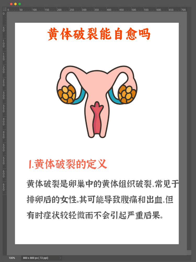 黄体破裂是什么原因导致的