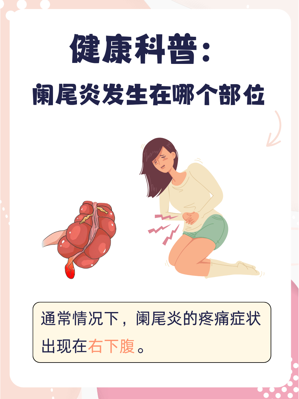 阑尾炎有几种治疗方法