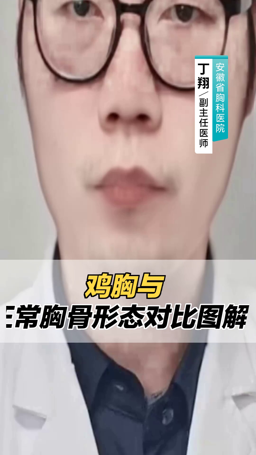 胸骨突出怎么办?怎么判断自己是否正常?