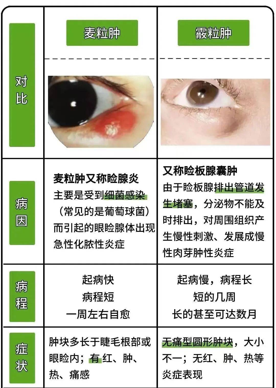 霰粒肿是怎么引起的
