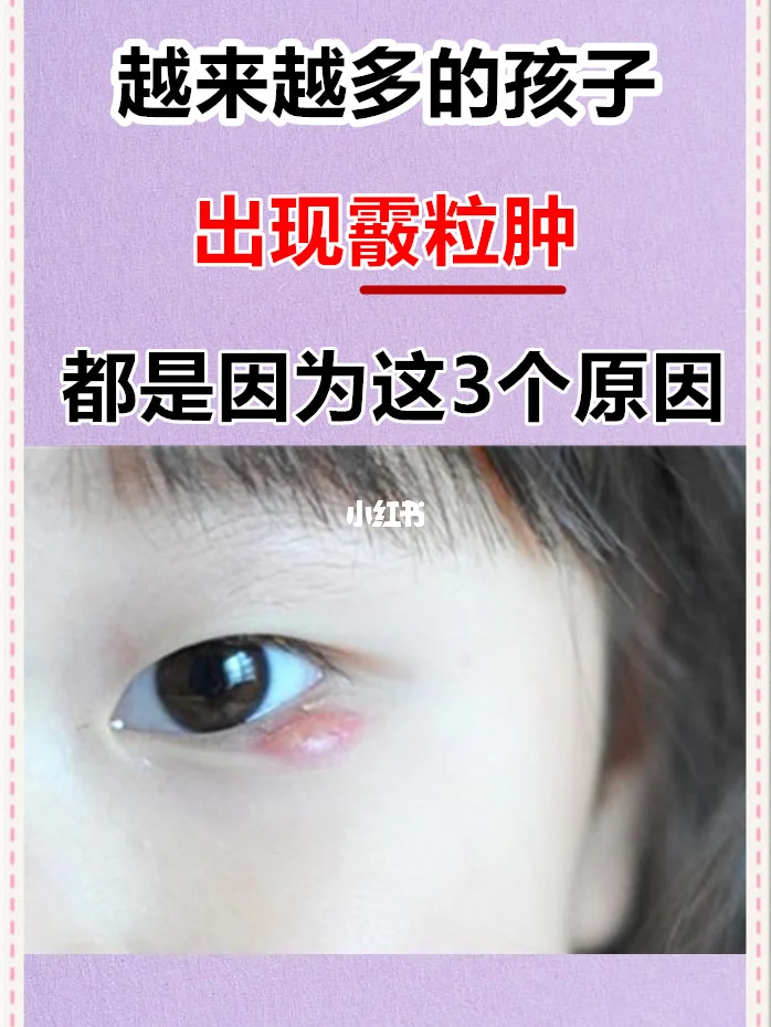 霰粒肿是怎么引起的
