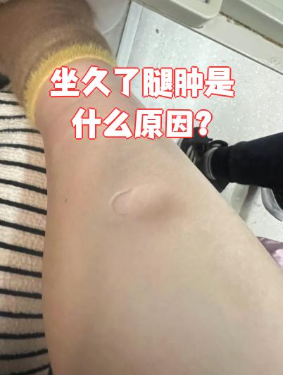 下肢浮肿会是什么病引起的?