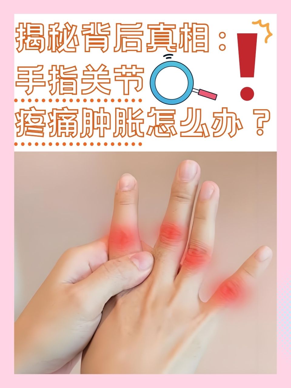 关节疼痛怎么办