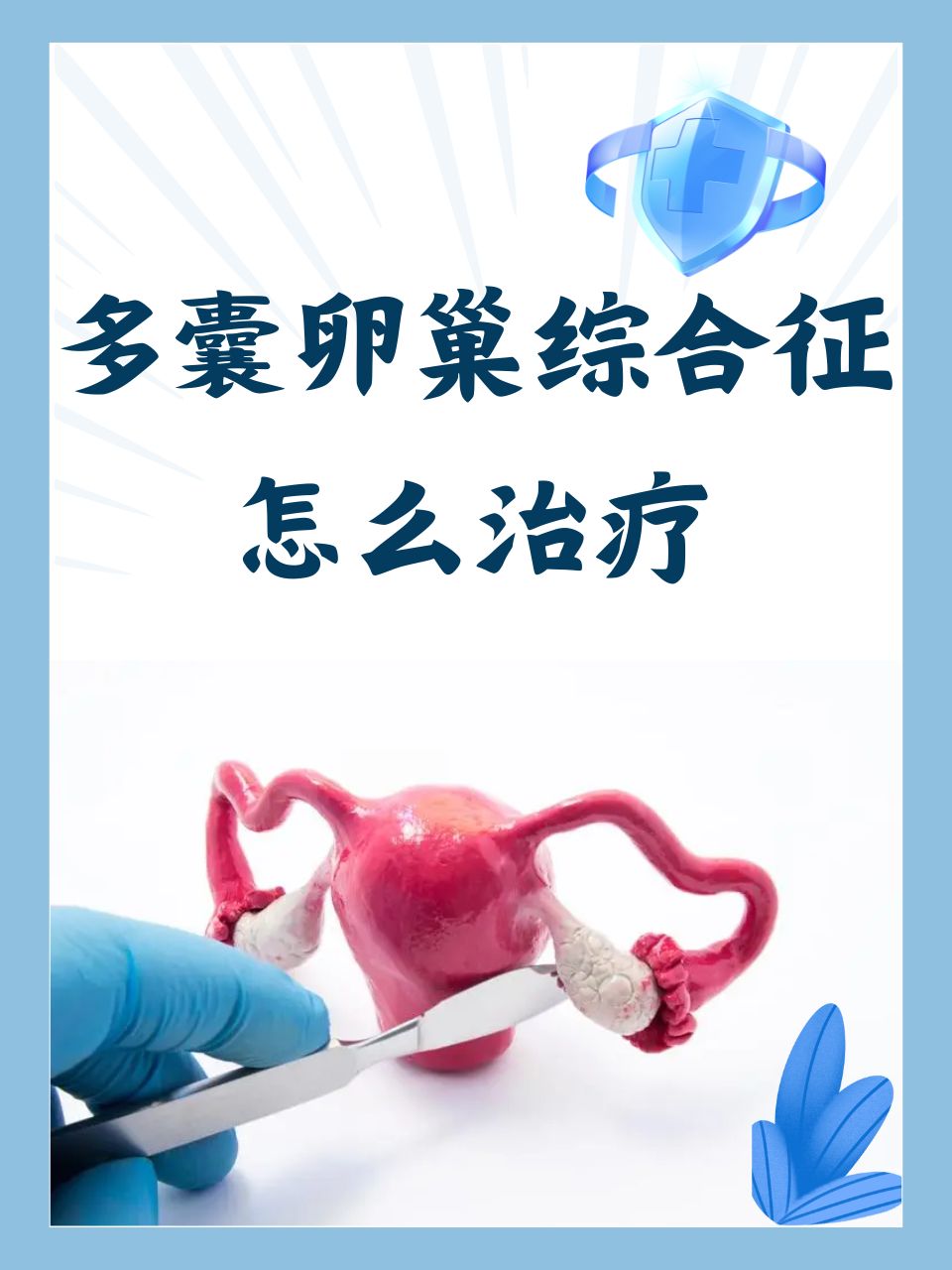 多卵巢综合症是什么病
