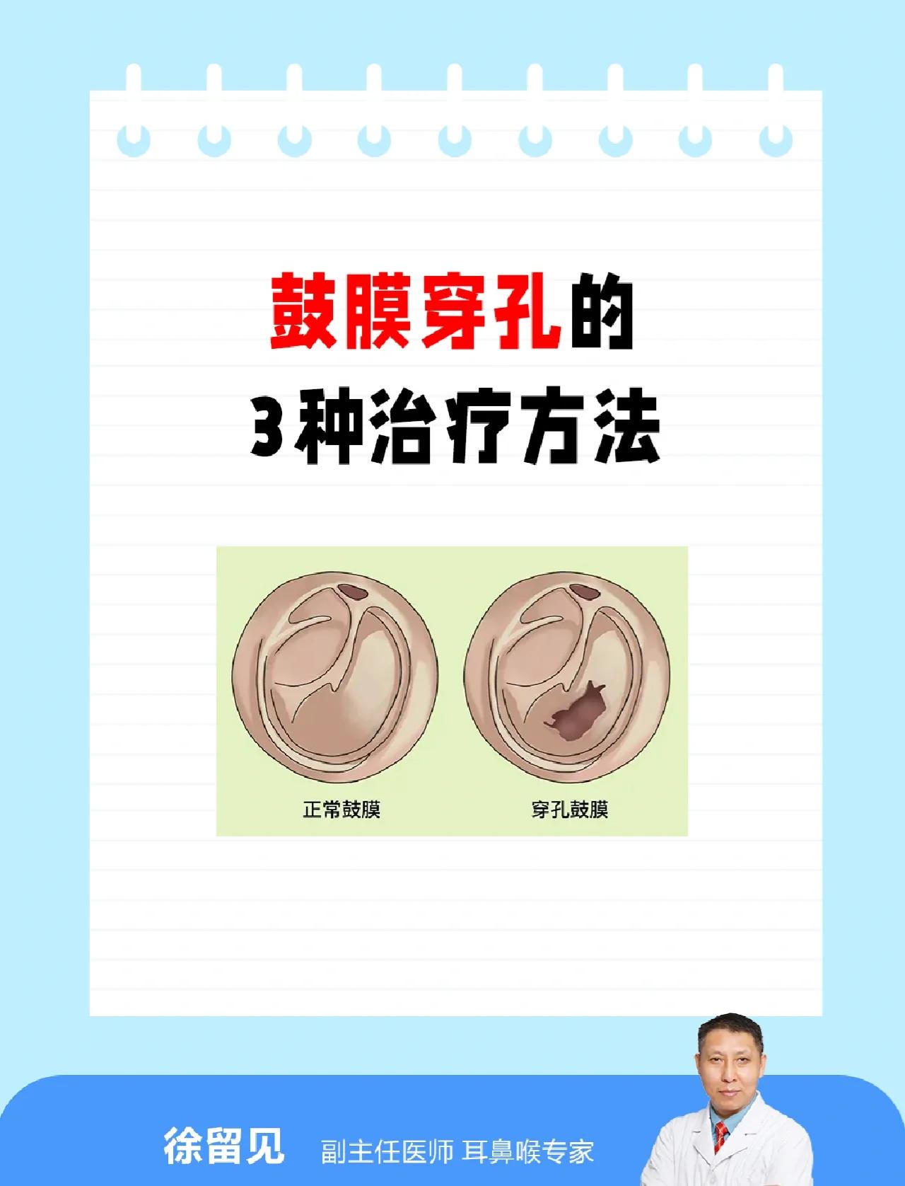 耳鼓膜穿孔手术有风险吗?