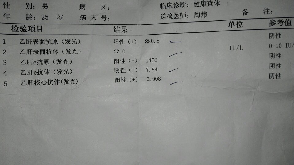 乙肝的检查