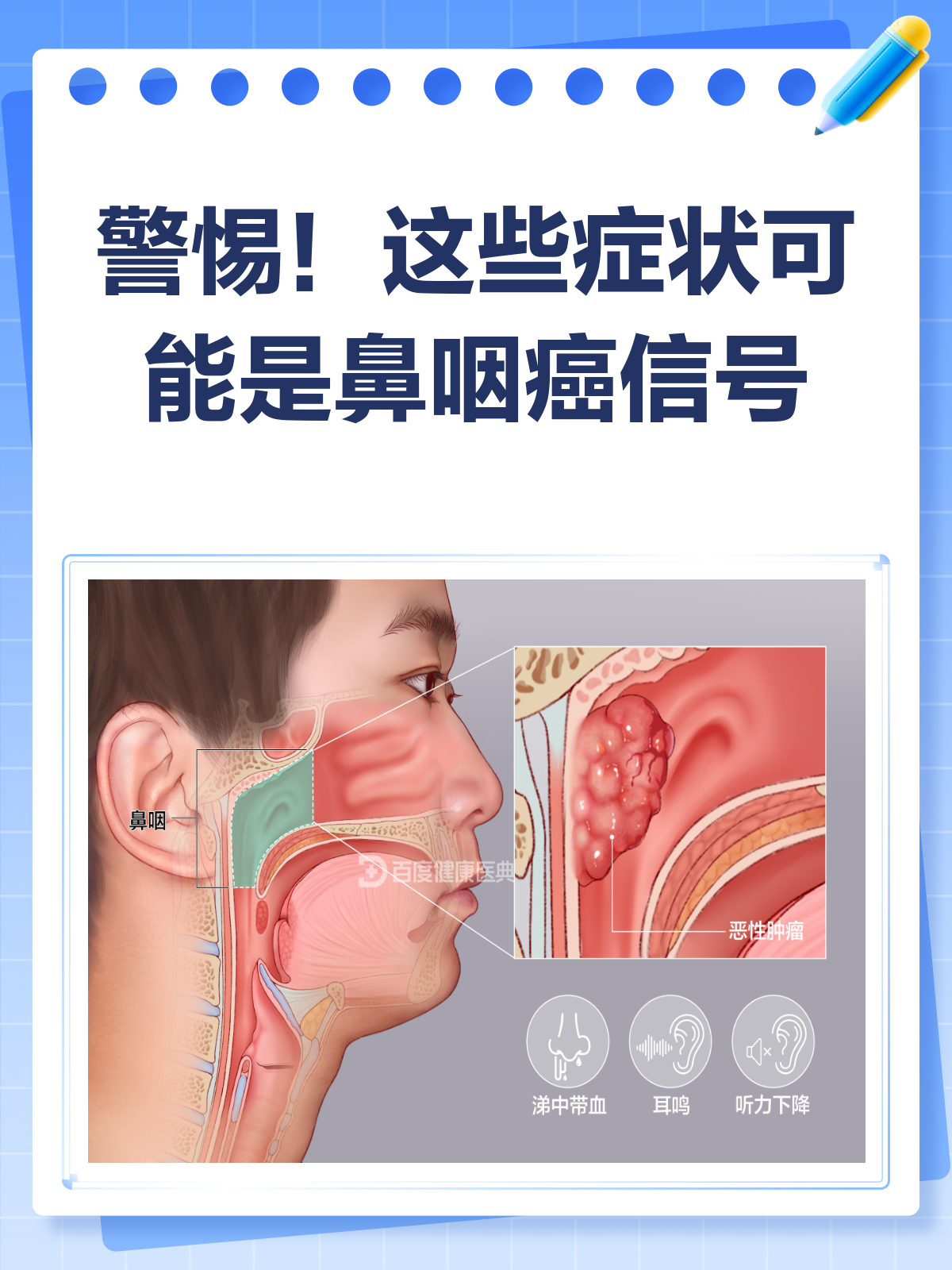 鼻咽癌的症状表现有哪些