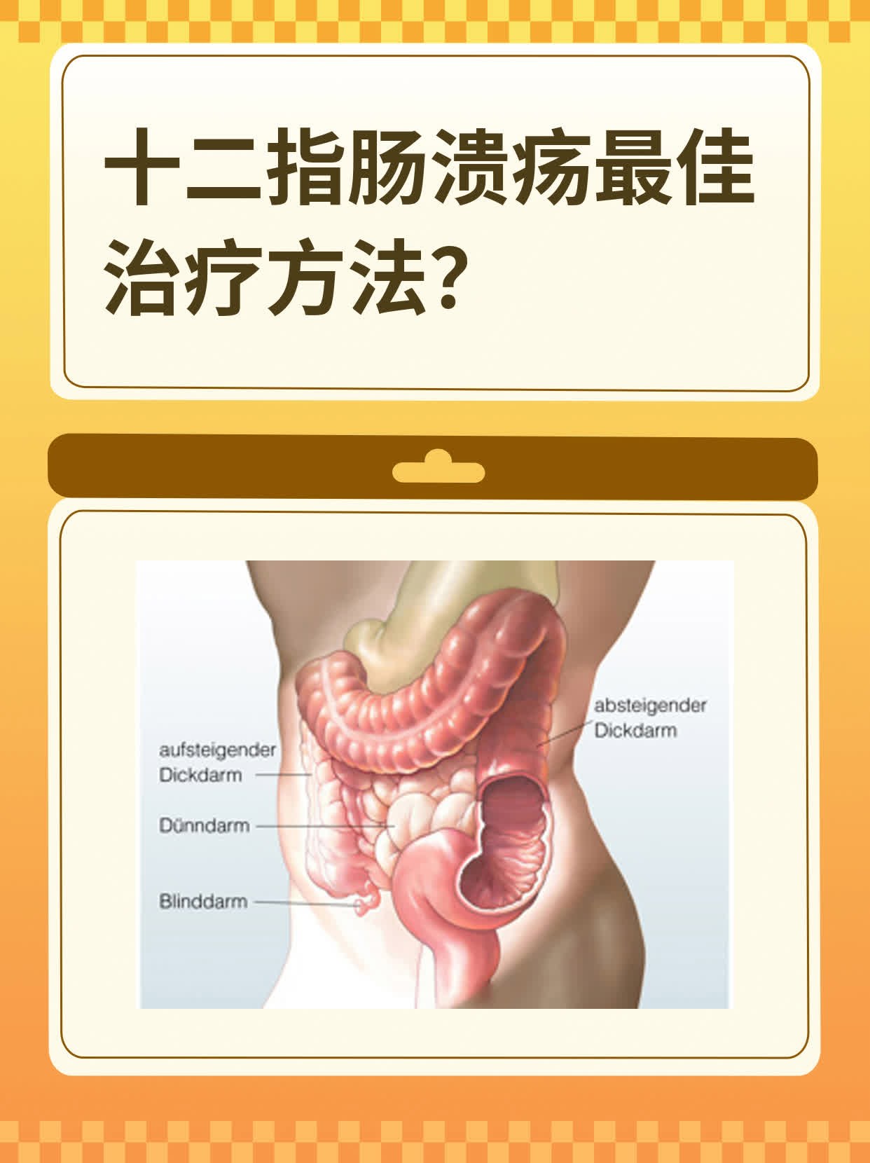 治疗胃酸最好的方法