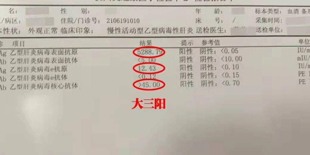 乙肝五项全是阴性是什么意思